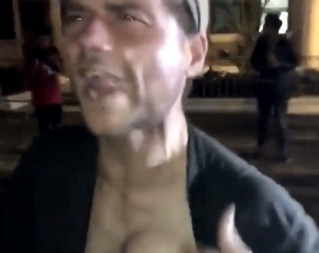 Insane video of a Man whose Heart Is Beating Out Of His Chest